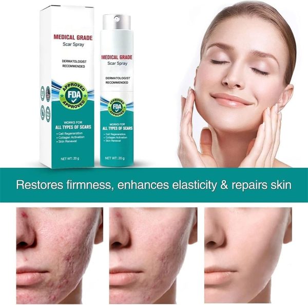 Scar Remove,scar Remove Medical Grade Scar Spray,medical Grade Scar Removal Spray,scar Removal Spray,scar Remove Spray,scar Spray,advanced Acne Scar Treatment For Face (1pcs)