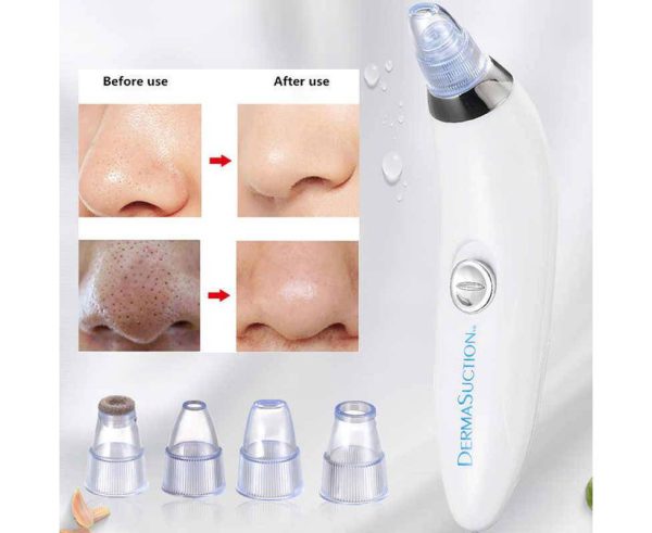 Derma suction Blackhead Remover Vacuum Acne Cleaner Black Spots Removal